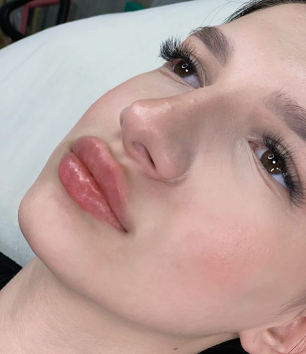 Контурна пластика губ!  2500грн.Потрібні моделі!