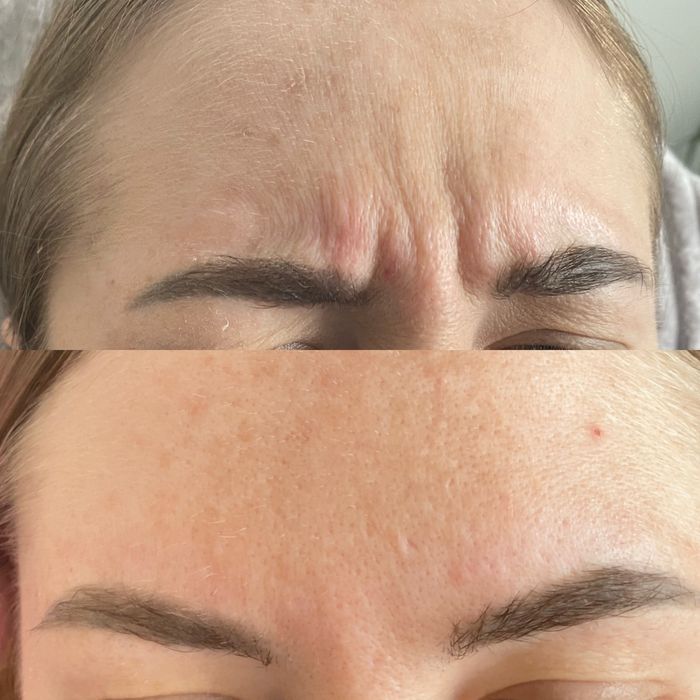 Ботулінотерапія та всі косметологічні послуги