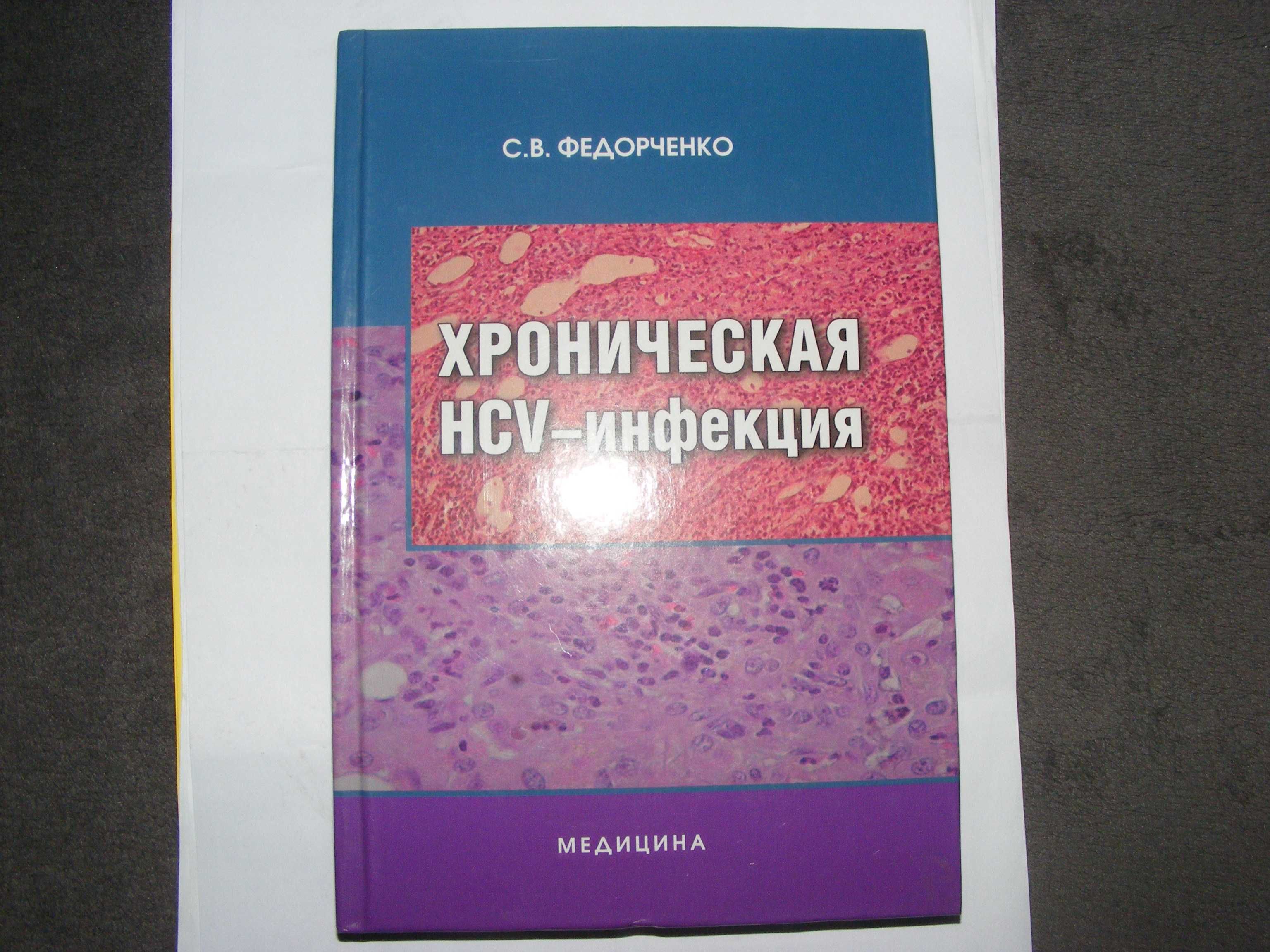 Книга Сергей Федорченко «Хроническая HCV-инфекция»