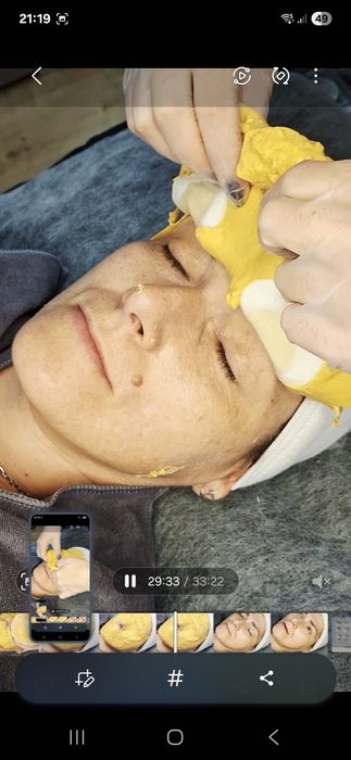 Естетична косметологія. Мікронідлінг