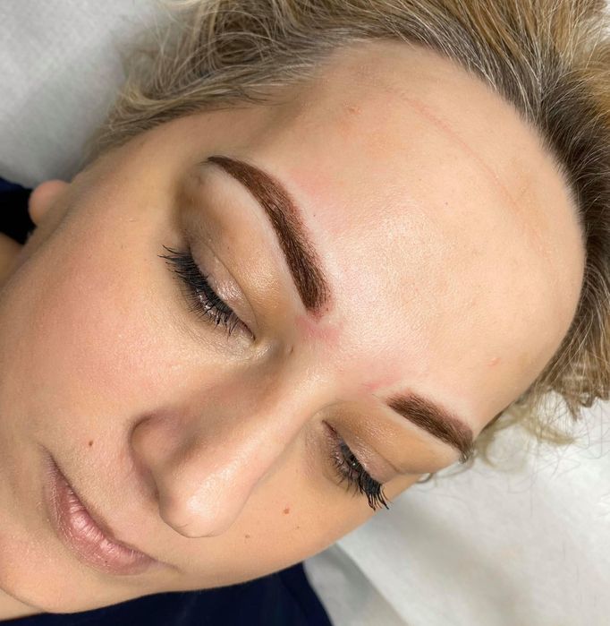 Btx ,Powiekszanie ust permanentny brwi i ust, stymulatory tkankowe