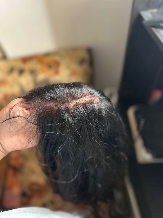 Lace “Cabelo.  “