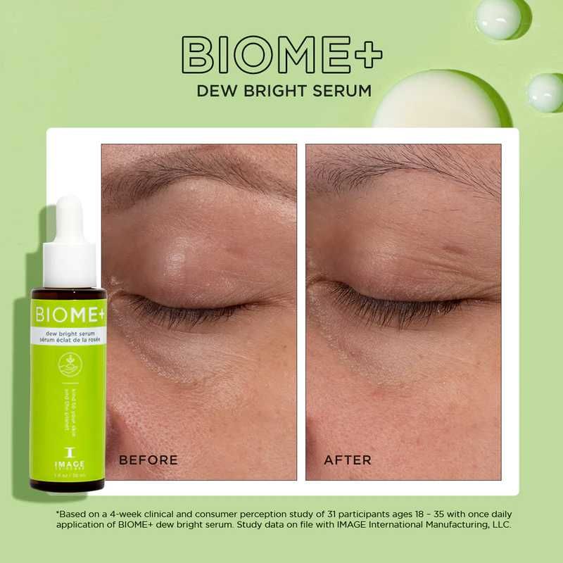 Сироватка для сяяння шкіри IMAGE Skincare BIOME+ Dew Bright Serum 30ml