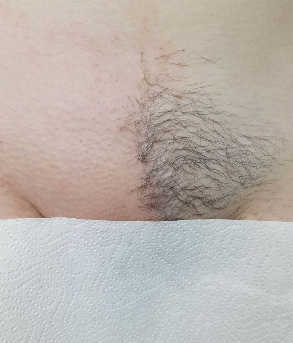 Воскова депіляція. Шугаринг. Павлоград (центр)