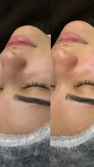 Якісна чистка обличчя  від 500