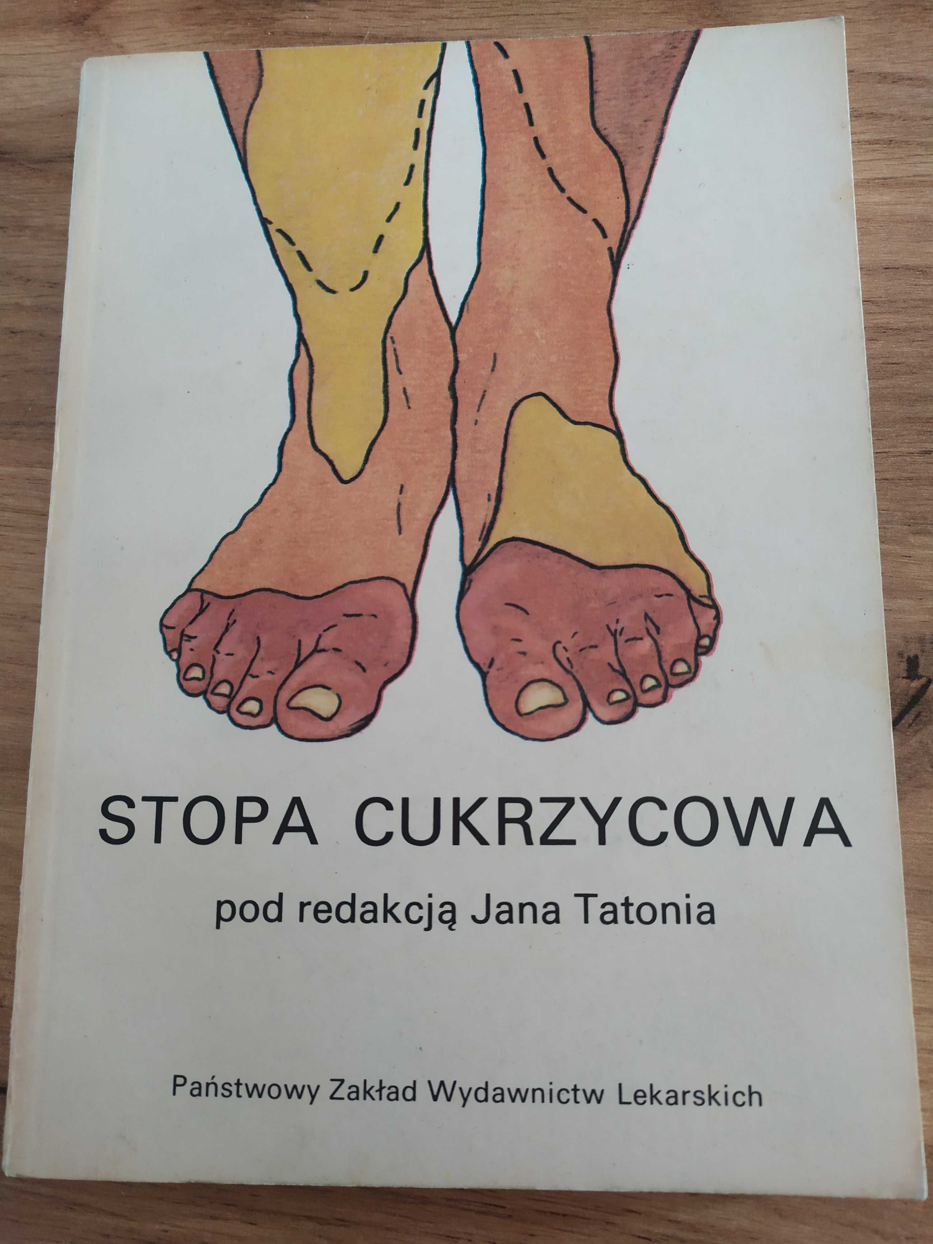 Stopa cukrzycowa książka