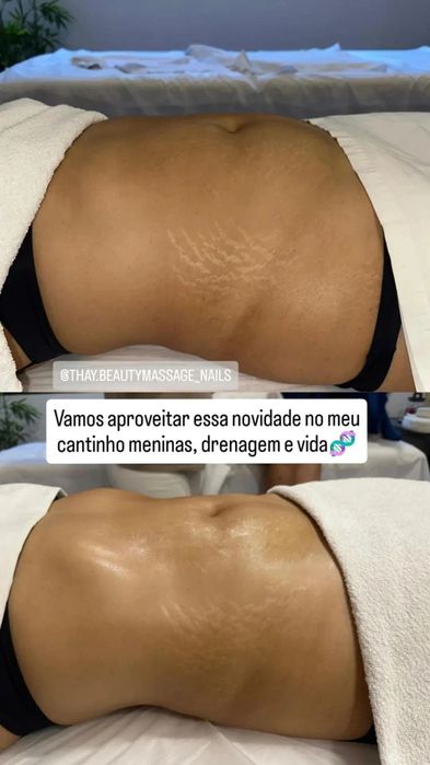 Pestanas, sobrancelhas, Extensão de Unhas, gelinho e drenagem linfátic