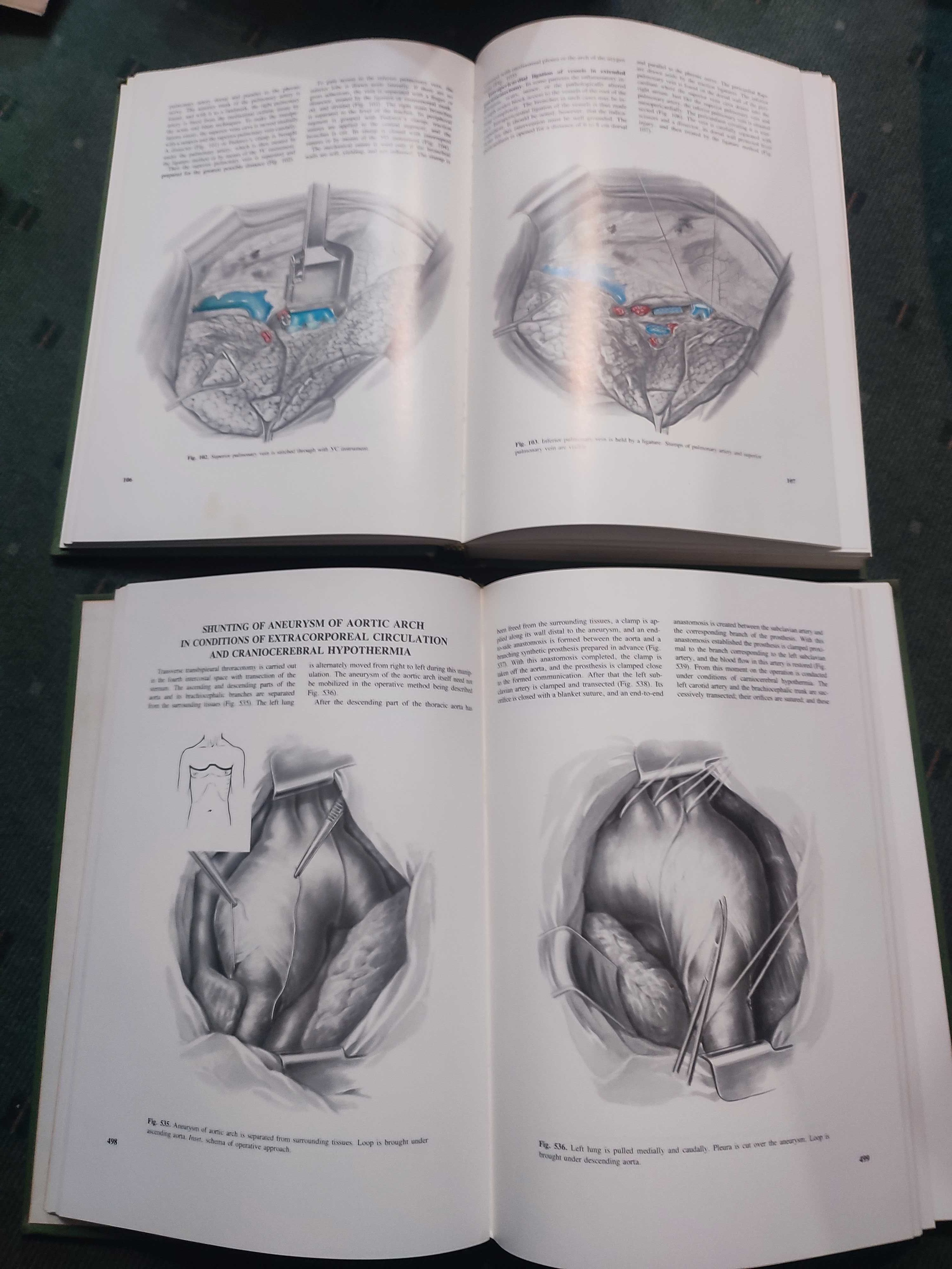 Atlas of Thoracic Surgery - Petrovsky - 2 volumes