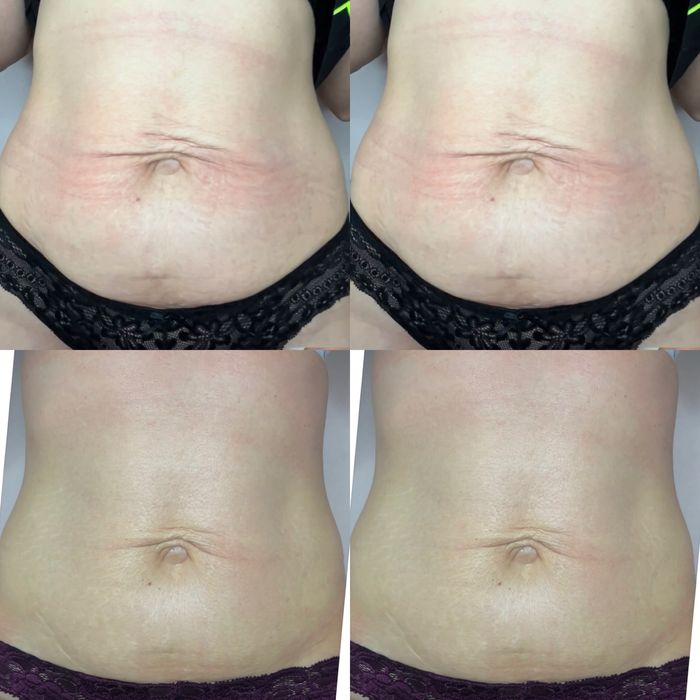 Масаж/ Обгортання/ Тейпування/ Мультимаскінг face