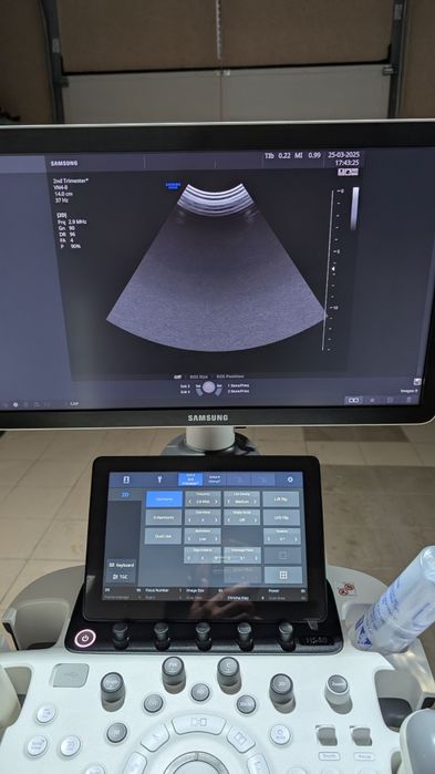 Продаю аппарат узи, узд Samsung HS 40