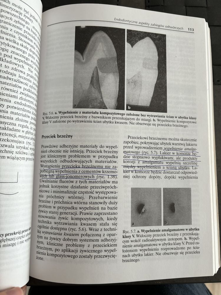 Endodoncja kliniczna Tronstad