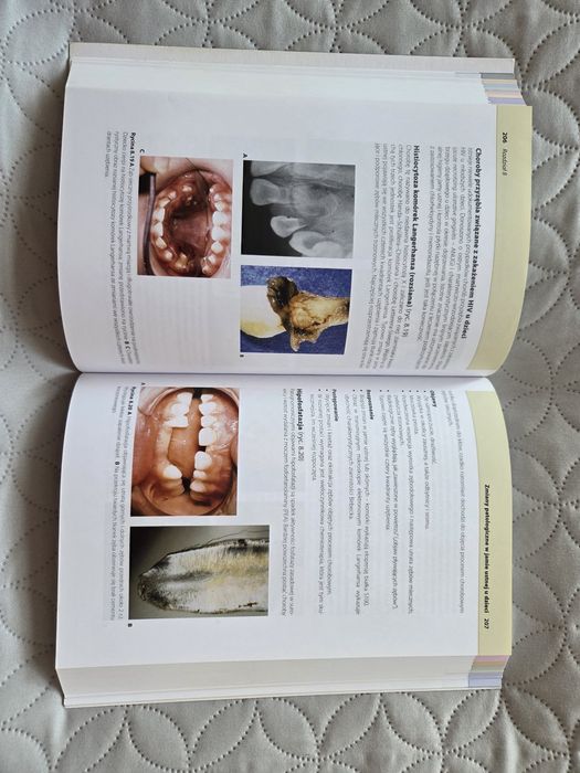 Stomatologia dziecięca Cameron, Widmer