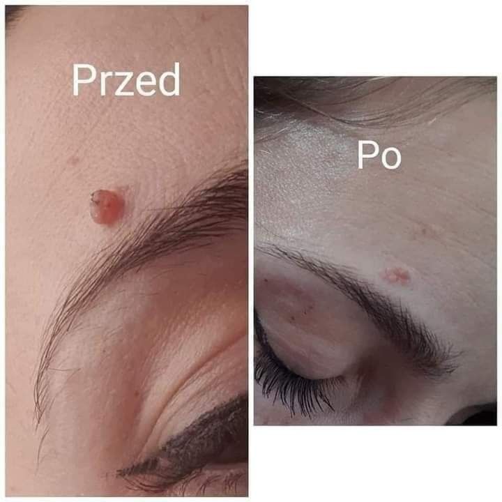 Sos serum  z drzewa herbacianego