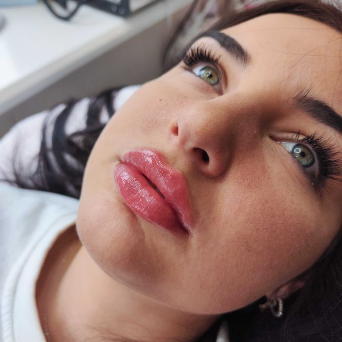 Увеличение губ, контурная коррекция