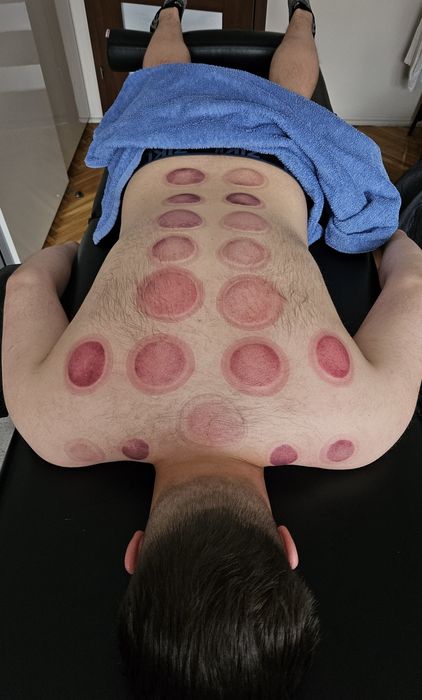 Masaż • Terapia manualna • Rozluźnianie mięśni i powięzi z dojazdem