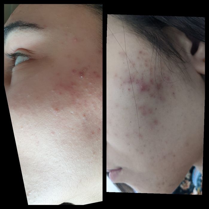 Косметолог- эстетист ,Теремки ,Голосеевский р-н. Выезд на дом .