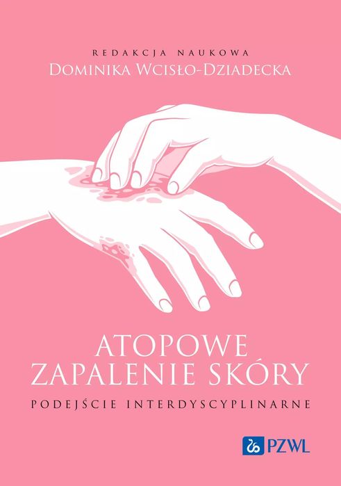 Atopowe Zapalenie Skóry. Podejście Interdyscyplinarne