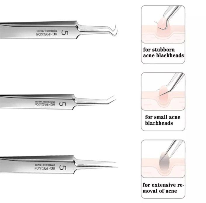Немецкие сверх тонкие пинцеты для удаления черных точек. Два Варианта
