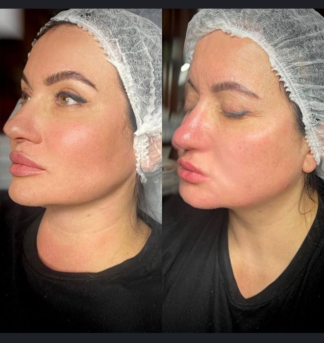 Косметолог Мукачево , по доступним цінам