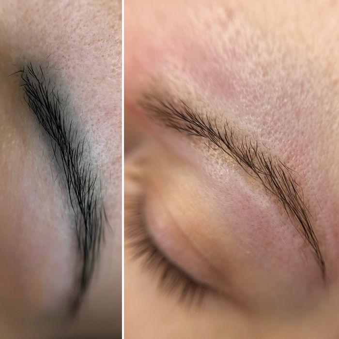 Лазерне видалення тату / татуаж / перманент