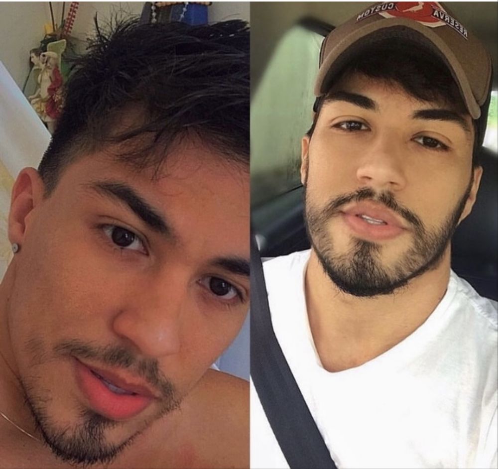 Minoxidi kirkland! Crescimento barba e cabelo