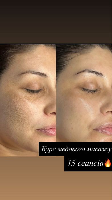 Послуги масажу. Та курси навчання масажу.