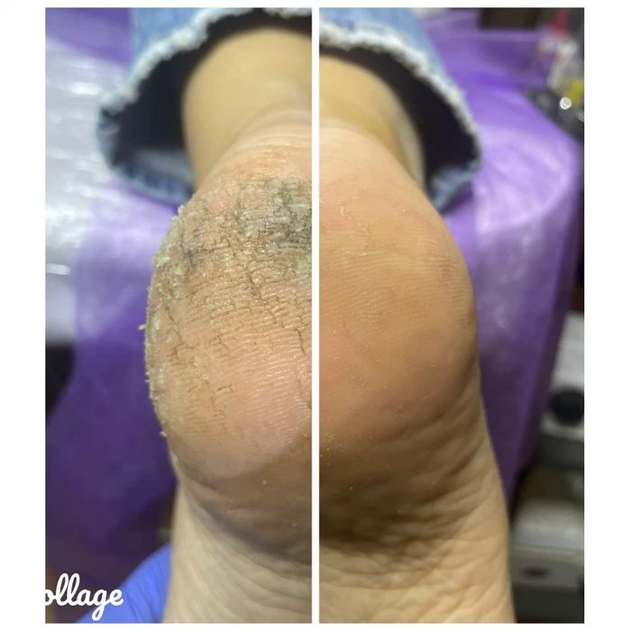 Подолог Харків, Центр. Подологічний педікюр