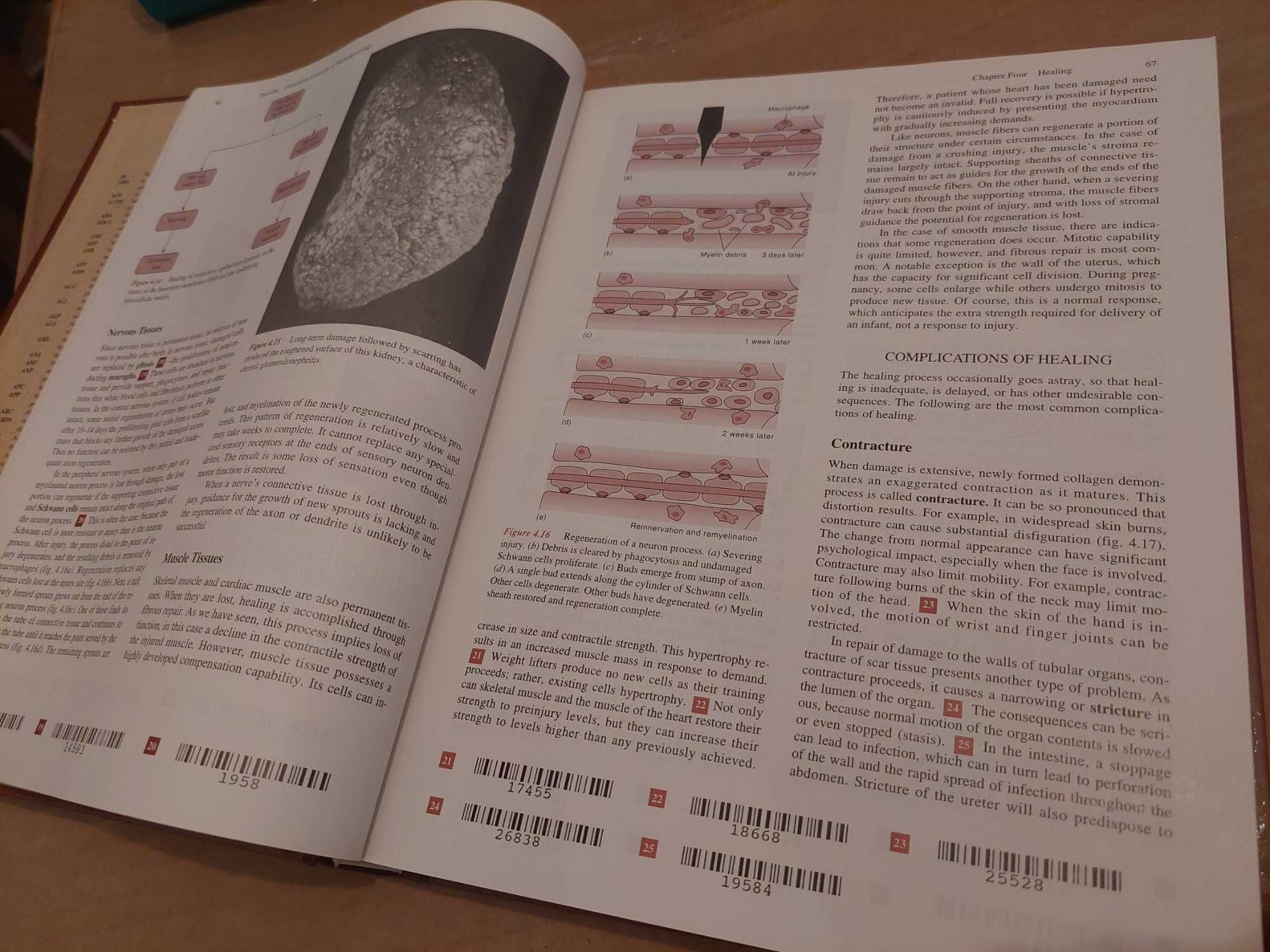 Livro Essentials of Pathophysiology - 2ª Edição, como novo