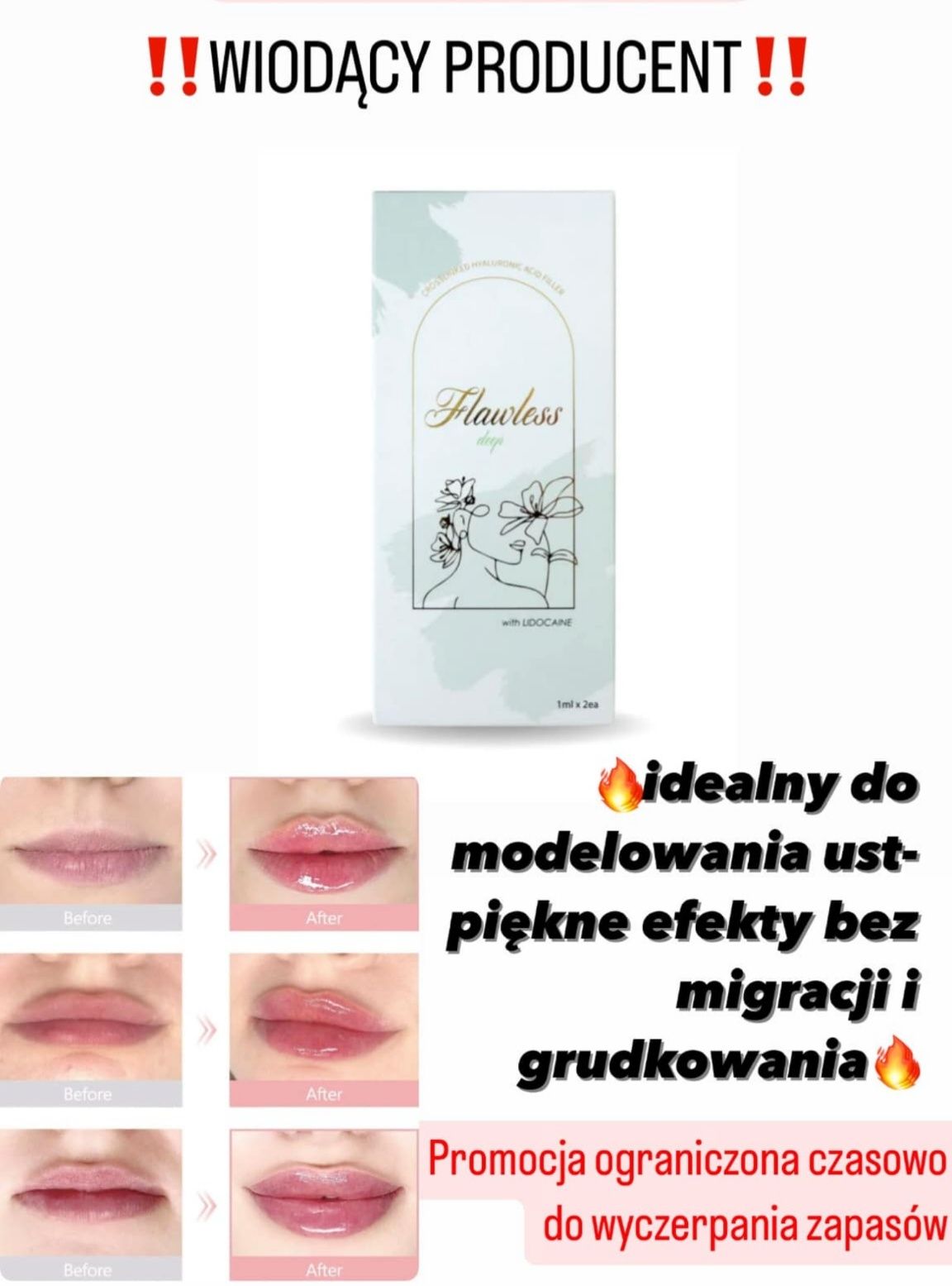 Flawless deep with lidocaine ( kwas hialuronowy)