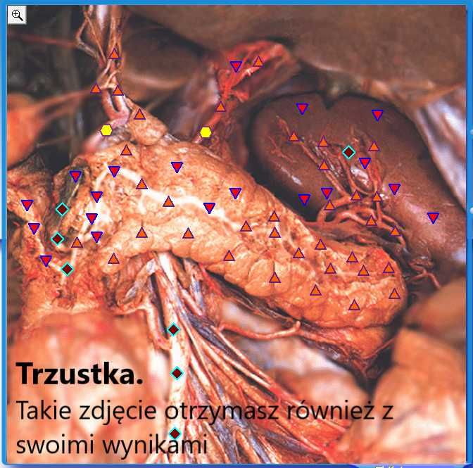 Badanie Biorezonansem-Diagnostyka Skanerem 3D - NEOMED Śląsk