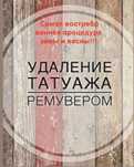 Видалення татуажу ремувером, Виноградар,Варшавський