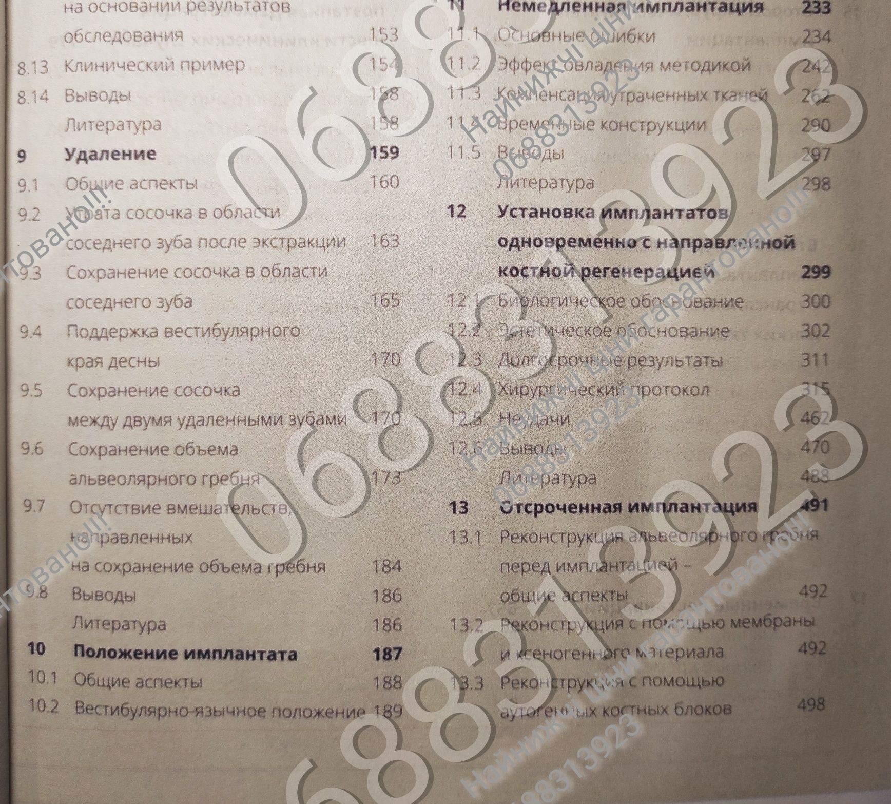 Дешево!! Имплантация в естетически значимой зоне, стоматологія