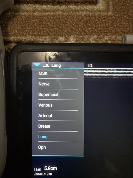 УЗД   SONOSITE iViz Portable  Ultrasound.