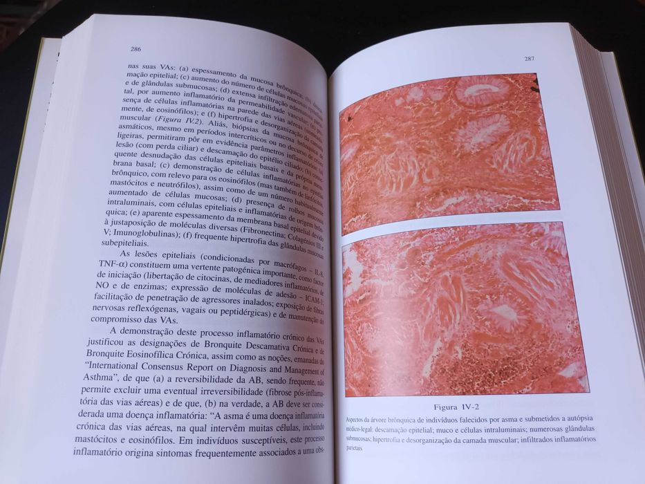 "Pneumologia Fundamental" por A.J.A. Robalo Cordeiro