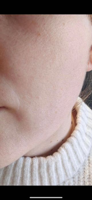 Дерматолог. Консультация онлайн