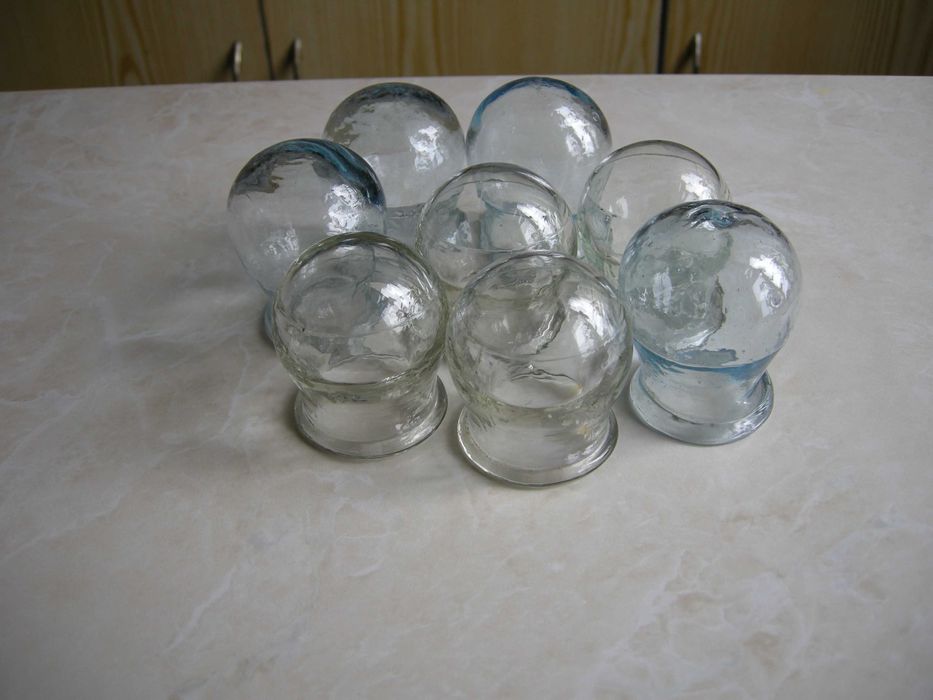 Медицинские стеклянные банки для вакуумного массажа, СССР