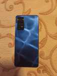Xiaomi note 11 pro 5g