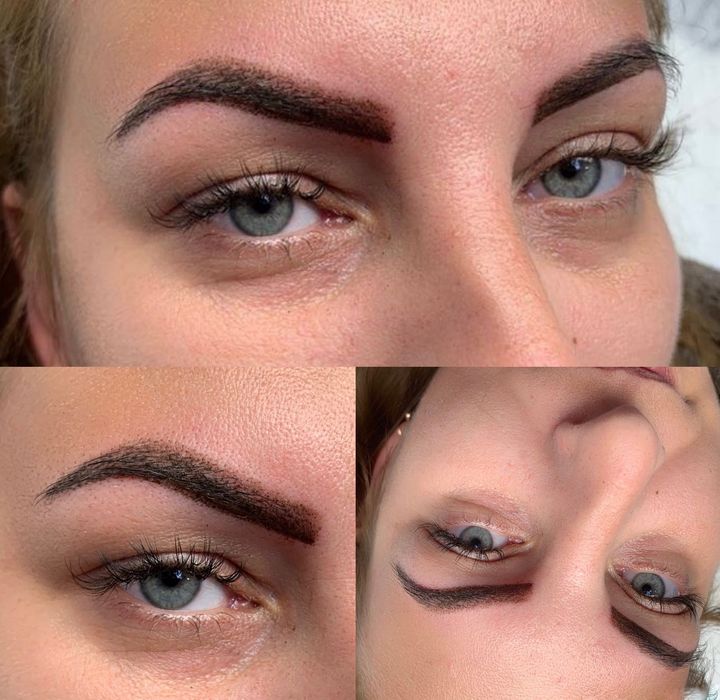 Btx ,Powiekszanie ust permanentny brwi i ust, stymulatory tkankowe