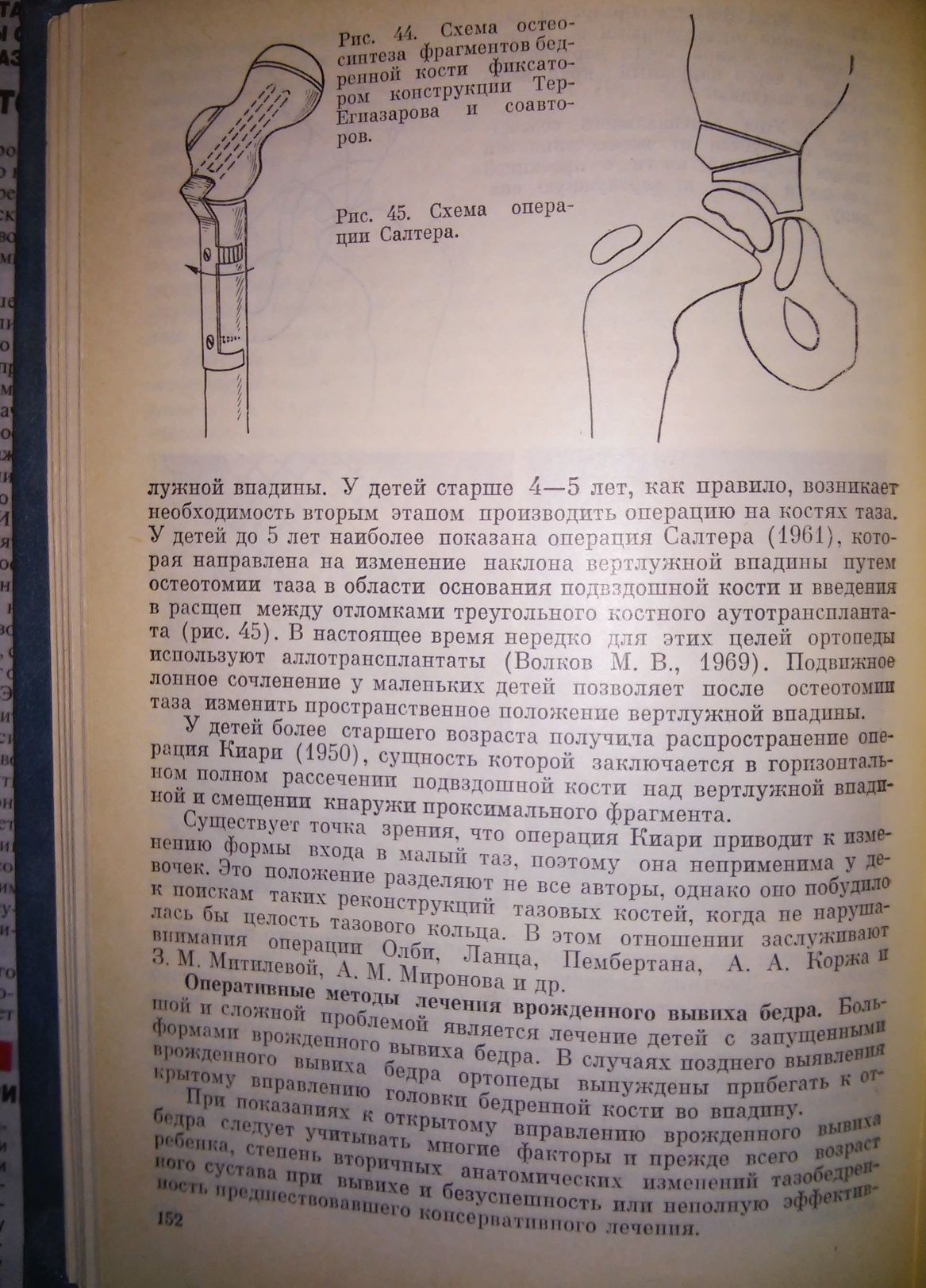 Волков Абальмасова Ортопедия и травматология детского возраста