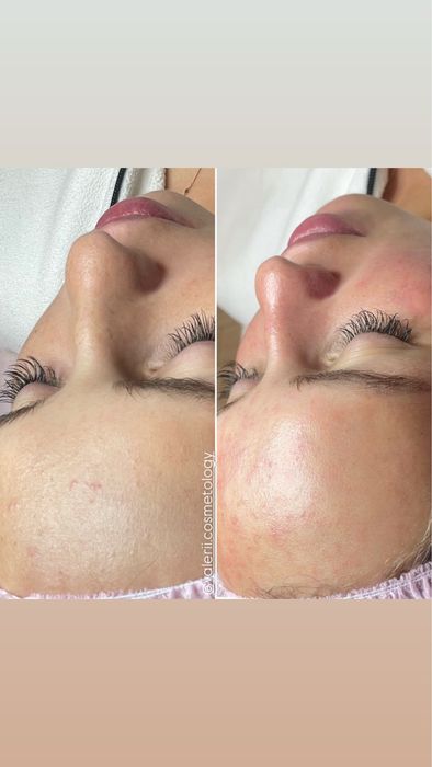 Косметолог Харків, м.Ярослава Мудрого