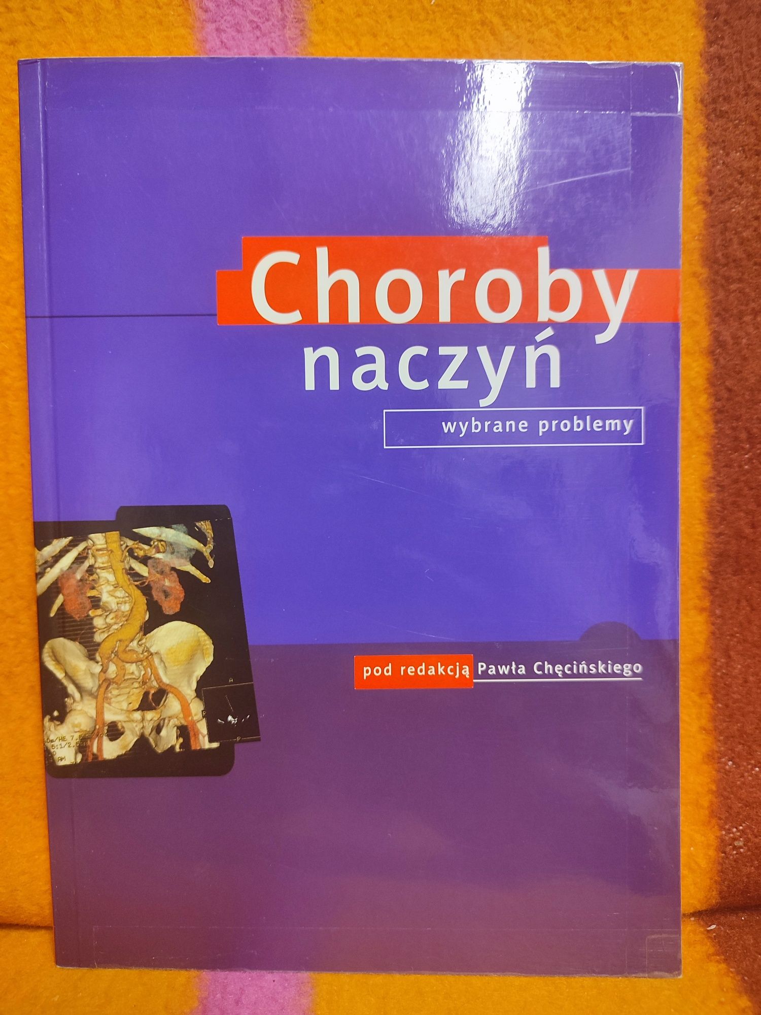 Choroby naczyń  P.Chęciński