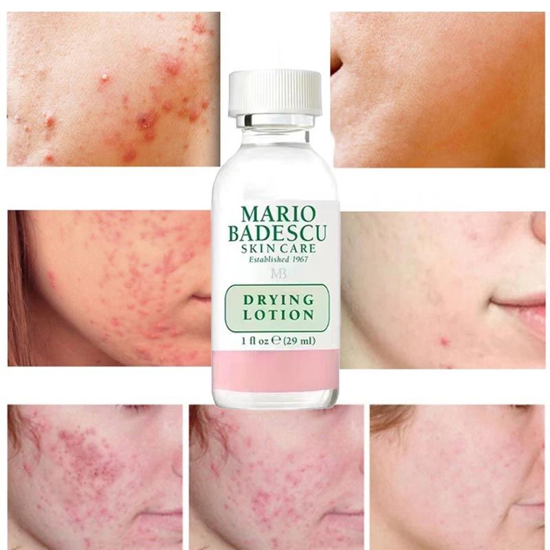 Mario BADESCU Drying Lotion Tonik WYSUSZAJĄCY 29ml