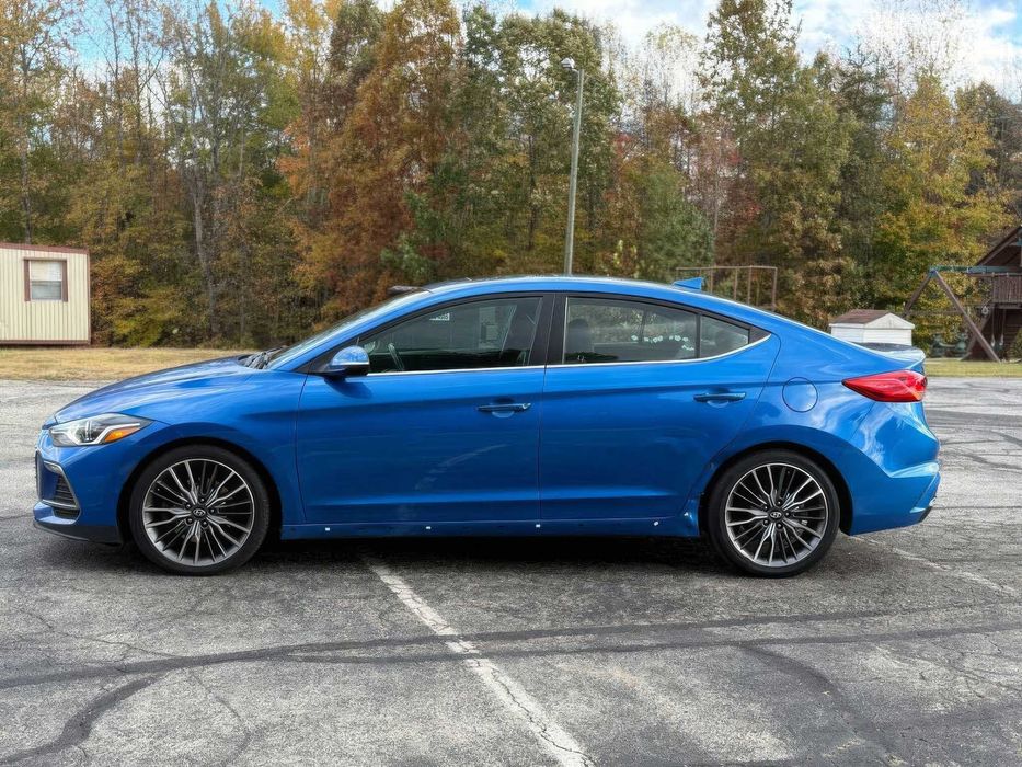 Hyundai Elantra      2018