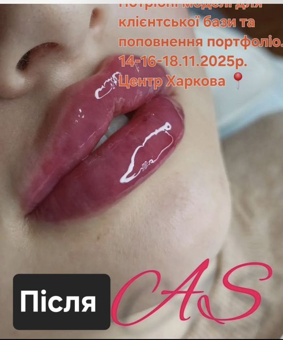 Косметолог/Ботокс/Збільшення губ/МОДЕЛІ