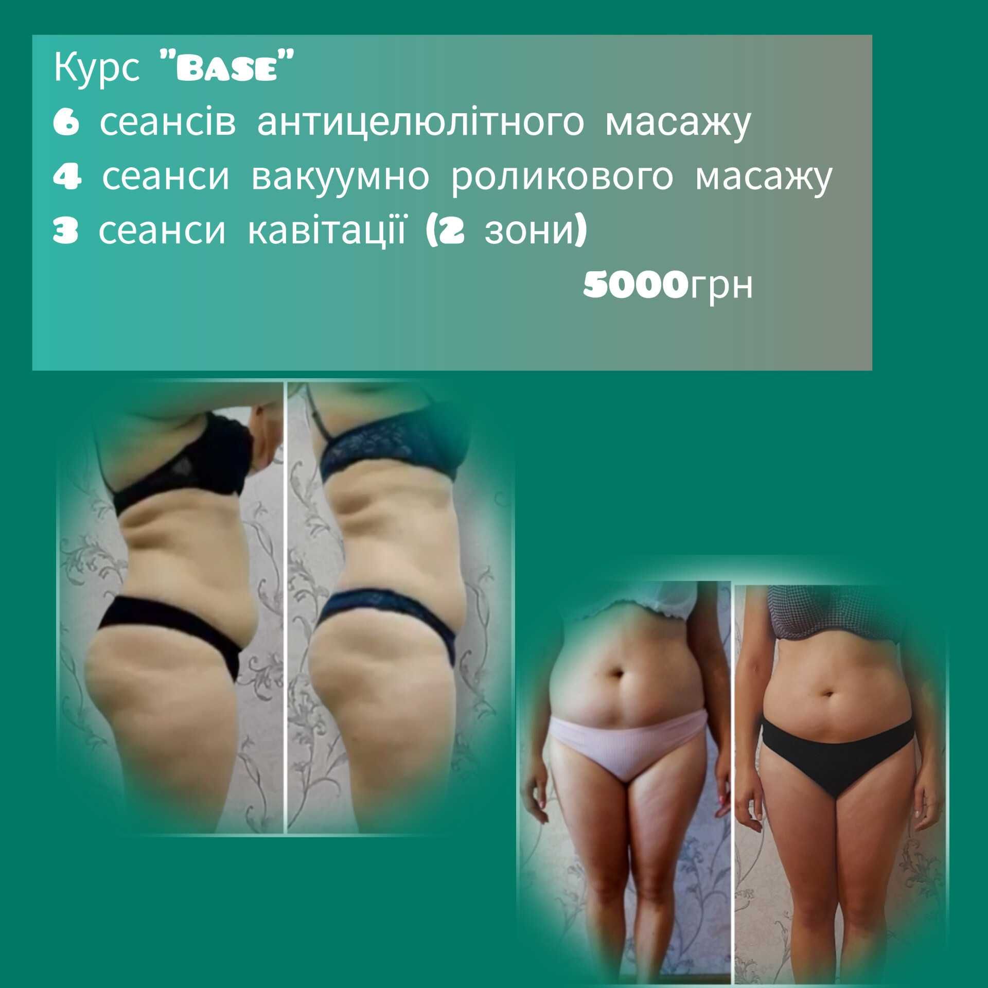 коррекция фигуры,кавитация, вакуумный, RF-лифтинг