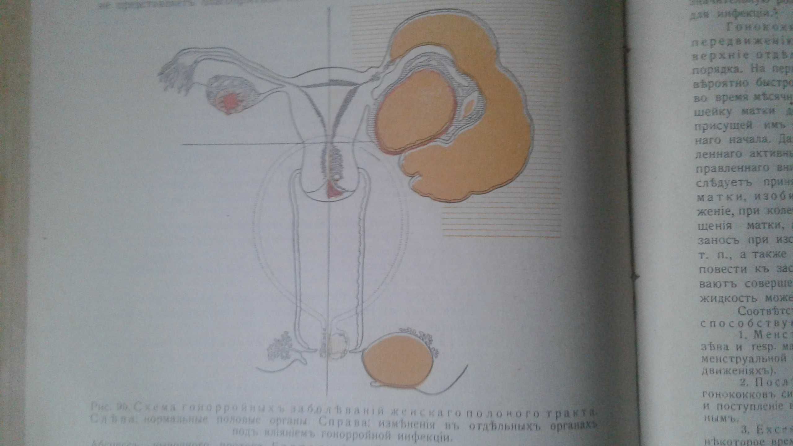 Гинекология 1914 год антикварная книга