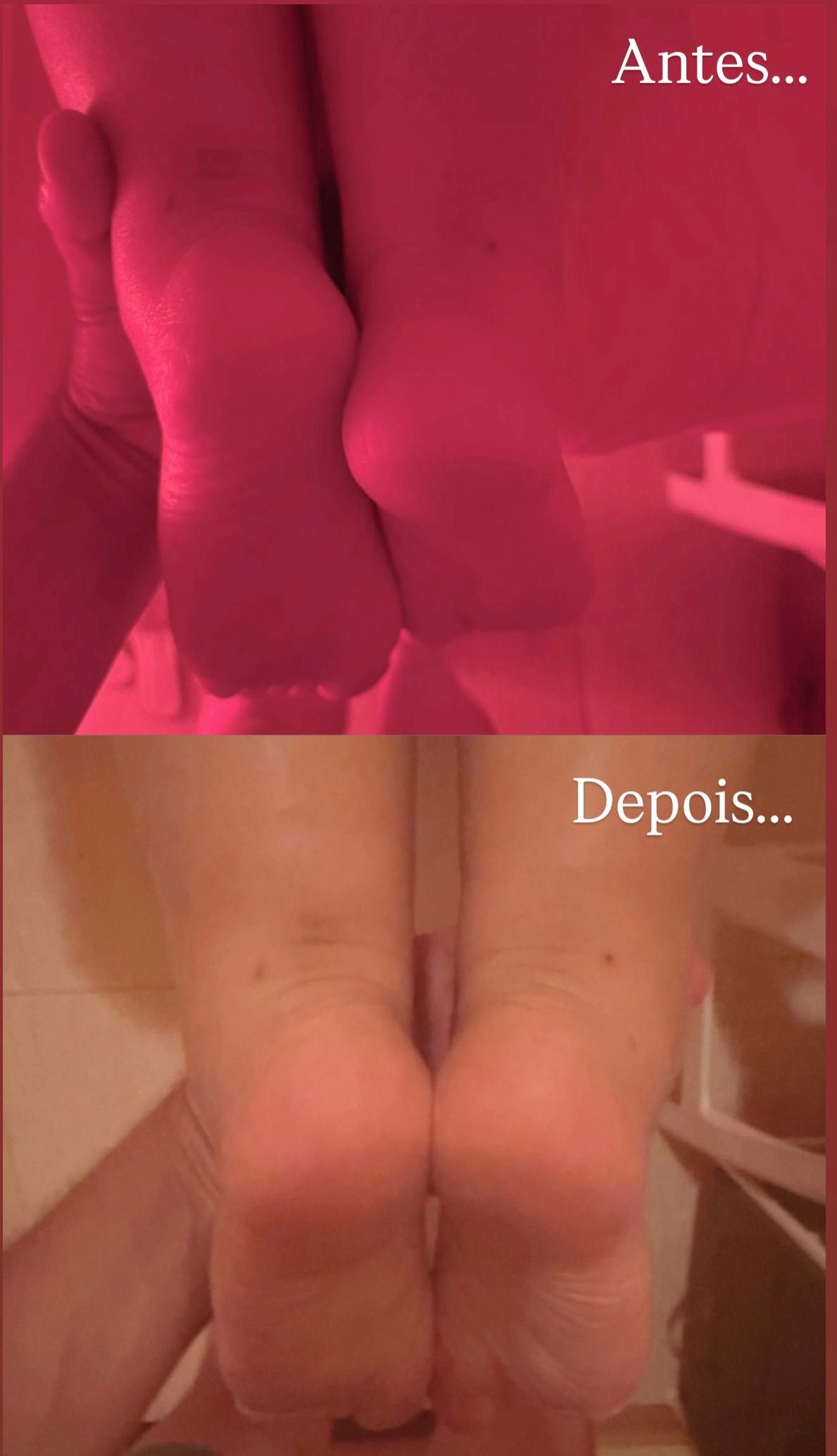 Massagem Terapêutica