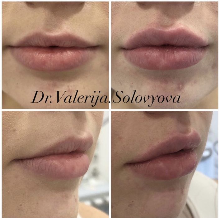 Косметолог Ужгород, інʼєкціоніст.