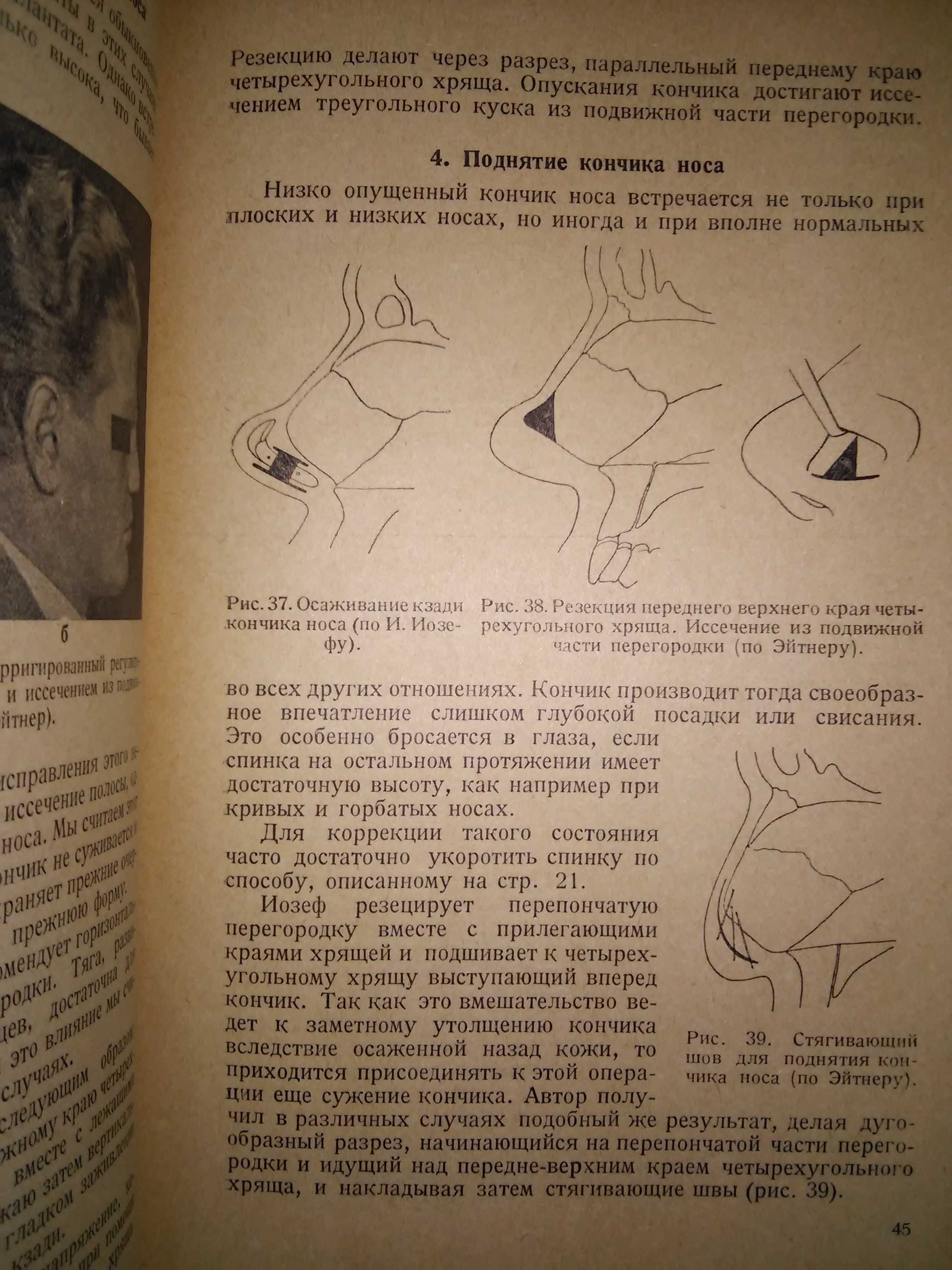 Эйтнер Косметические операции Краткое руководство 1936