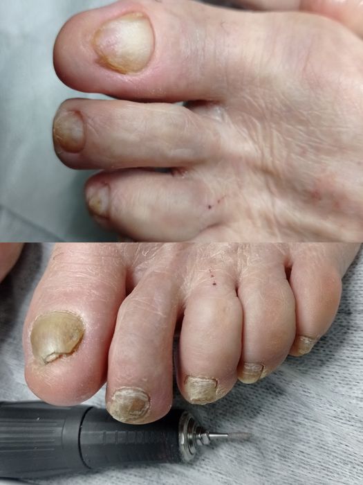 Дмитровка,Горишние плавни ,педекюр